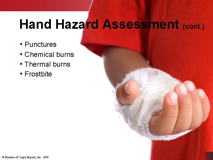 Hand Hazard Assessment (cont. ) • Punctures • Chemical burns • Thermal burns •