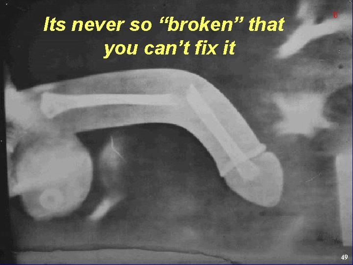 Its never so “broken” that you can’t fix it U 49 