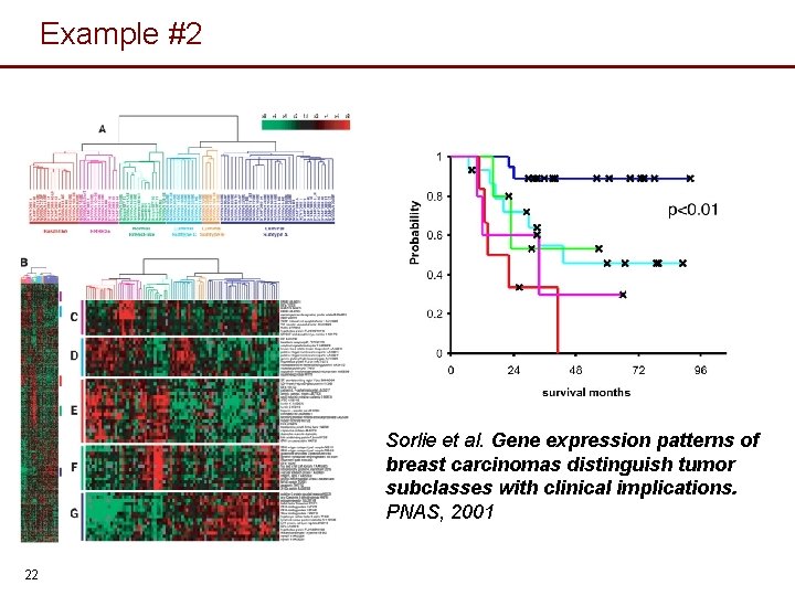 Example #2 Sorlie et al. Gene expression patterns of breast carcinomas distinguish tumor subclasses