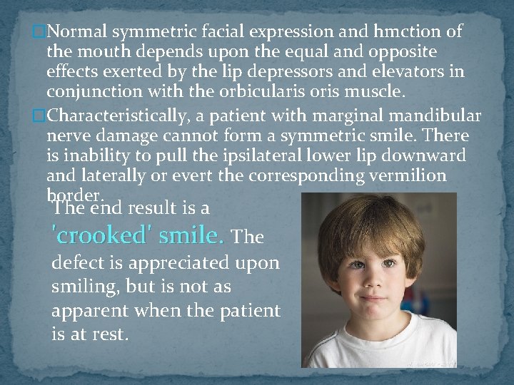 �Normal symmetric facial expression and hmction of the mouth depends upon the equal and