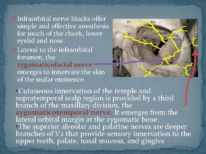 � Infraorbital nerve blocks offer simple and effective anesthesia for much of the cheek,