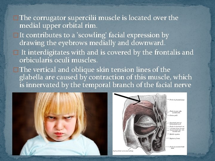 � The corrugator supercilii muscle is located over the medial upper orbital rim. �