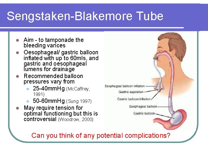 Sengstaken-Blakemore Tube Aim - to tamponade the bleeding varices l Oesophageal/ gastric balloon inflated