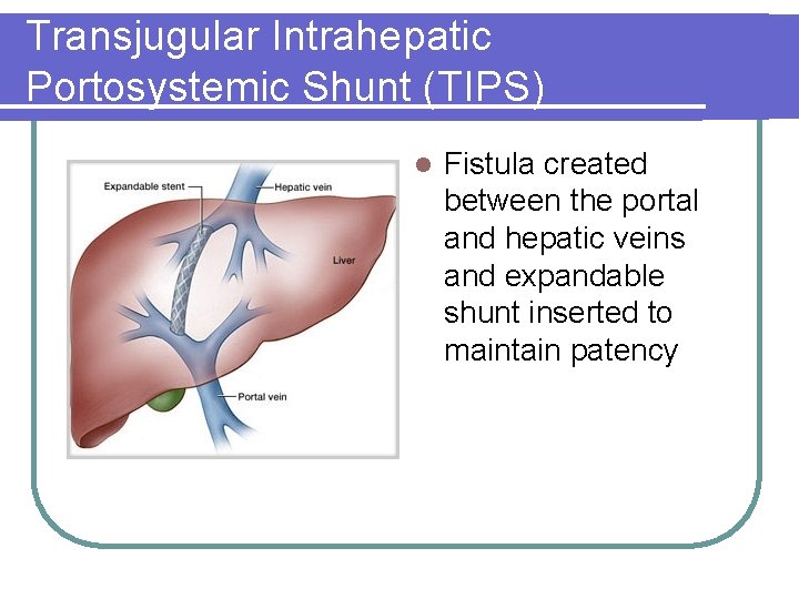 Transjugular Intrahepatic Portosystemic Shunt (TIPS) l Fistula created between the portal and hepatic veins