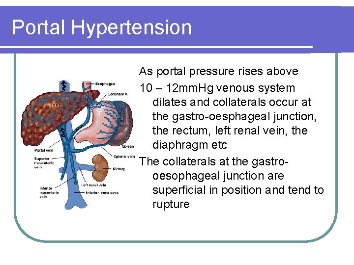 Portal Hypertension As portal pressure rises above 10 – 12 mm. Hg venous system