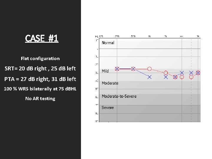 CASE #1 Flat configuration SRT= 20 d. B right , 25 d. B left