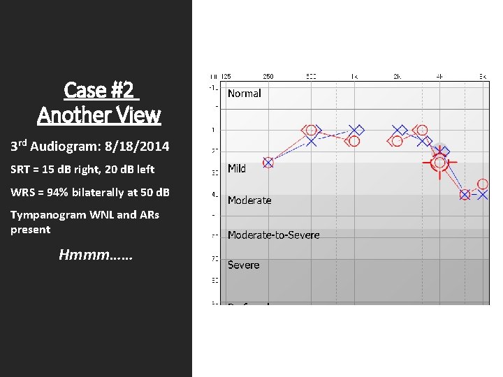 Case #2 Another View 3 rd Audiogram: 8/18/2014 SRT = 15 d. B right,