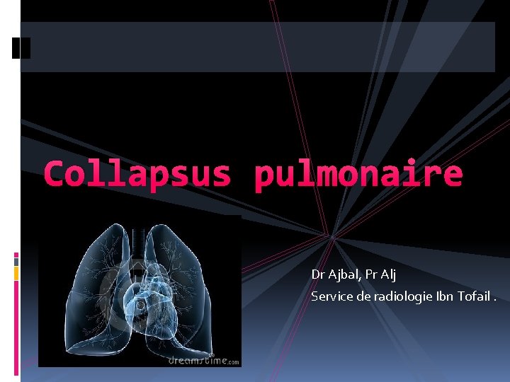 Collapsus pulmonaire Dr Ajbal, Pr Alj Service de radiologie Ibn Tofail. 