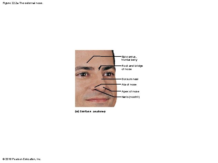 Figure 22. 2 a The external nose. Epicranius, frontal belly Root and bridge of