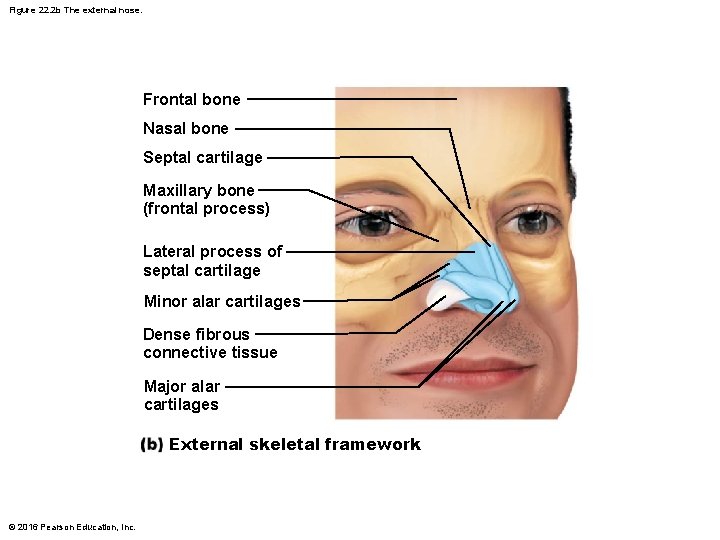 Figure 22. 2 b The external nose. Frontal bone Nasal bone Septal cartilage Maxillary