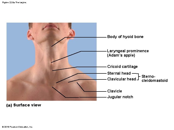 Figure 22. 5 a The larynx. Body of hyoid bone Laryngeal prominence (Adam’s apple)