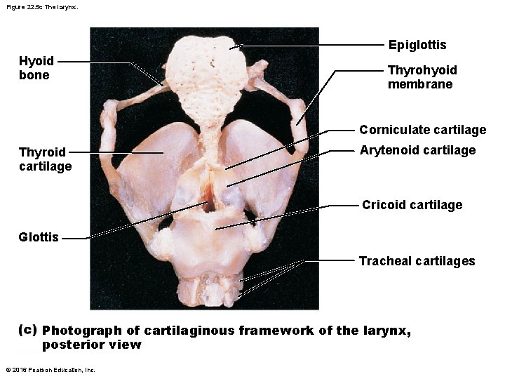 Figure 22. 5 c The larynx. Epiglottis Hyoid bone Thyrohyoid membrane Corniculate cartilage Thyroid