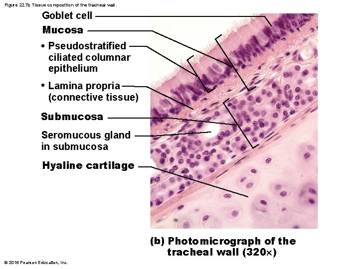 Figure 22. 7 b Tissue composition of the tracheal wall. Goblet cell Mucosa •