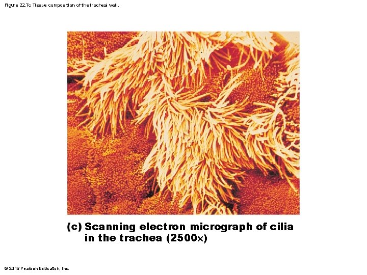 Figure 22. 7 c Tissue composition of the tracheal wall. Scanning electron micrograph of