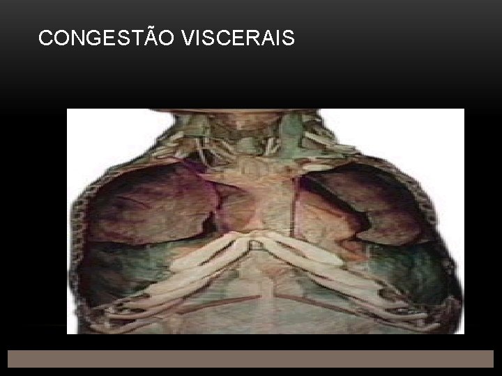 CONGESTÃO VISCERAIS 