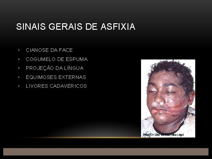 SINAIS GERAIS DE ASFIXIA • CIANOSE DA FACE • COGUMELO DE ESPUMA • PROJEÇÃO