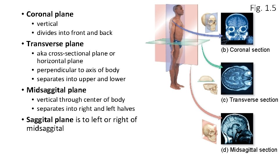  • Coronal plane Fig. 1. 5 • vertical • divides into front and