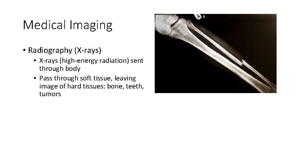 Medical Imaging • Radiography (X-rays) • X-rays (high-energy radiation) sent through body • Pass