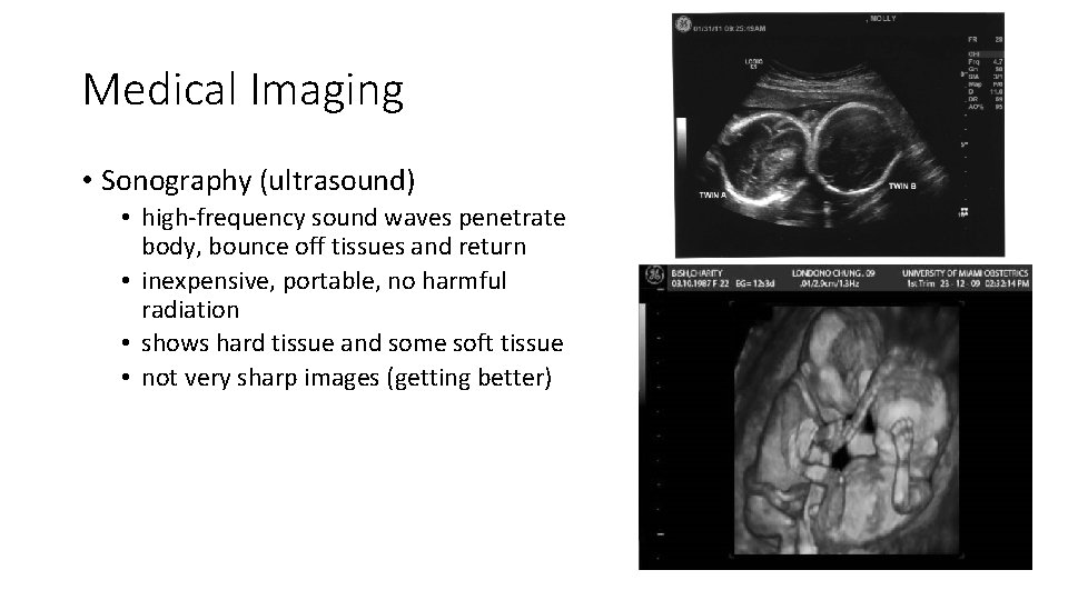 Medical Imaging • Sonography (ultrasound) • high-frequency sound waves penetrate body, bounce off tissues