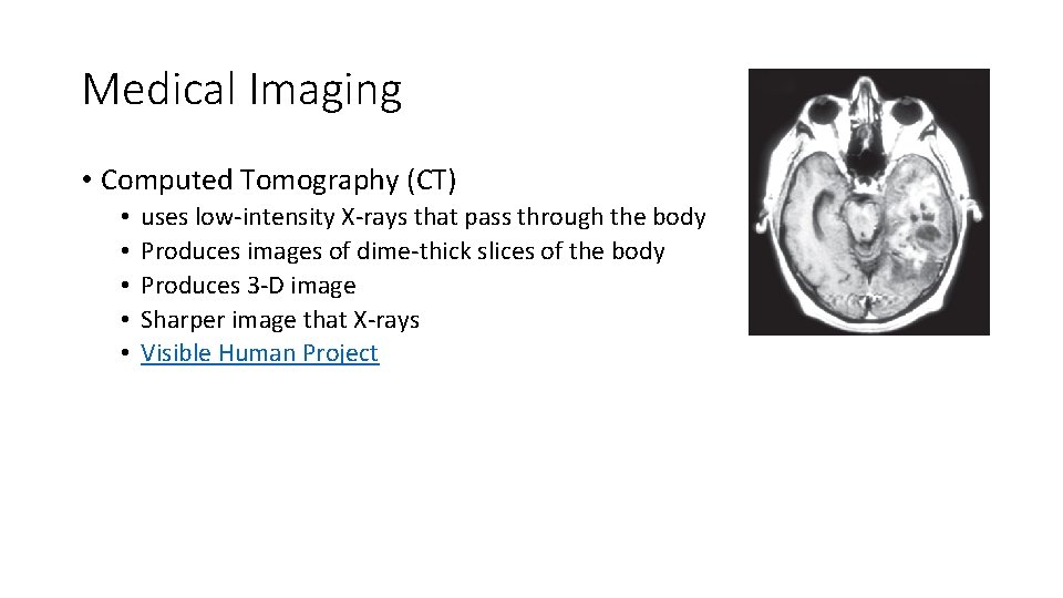 Medical Imaging • Computed Tomography (CT) • • • uses low-intensity X-rays that pass