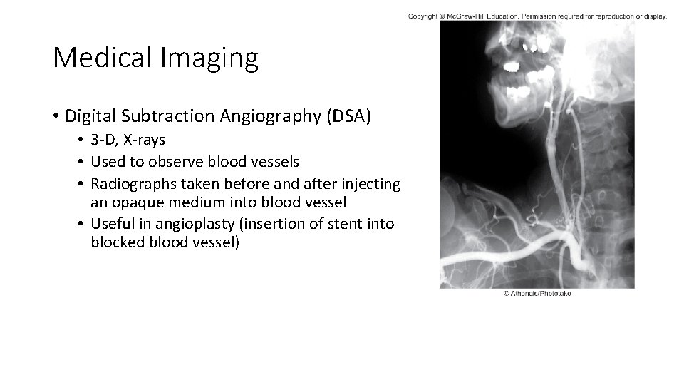 Medical Imaging • Digital Subtraction Angiography (DSA) • 3 -D, X-rays • Used to