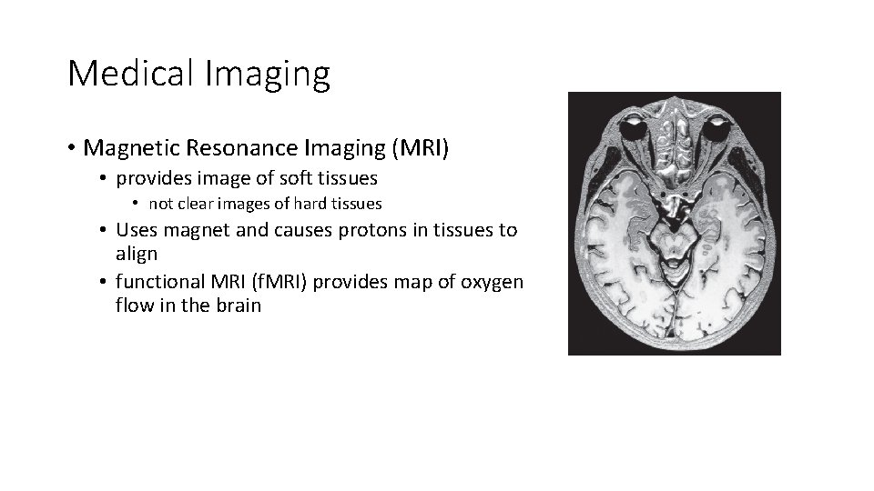 Medical Imaging • Magnetic Resonance Imaging (MRI) • provides image of soft tissues •