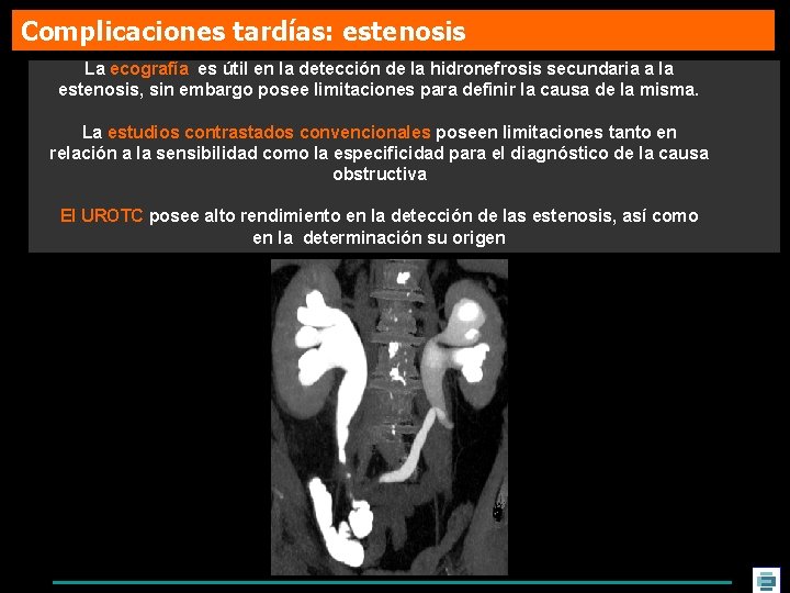 Complicaciones tardías: estenosis La ecografía es útil en la detección de la hidronefrosis secundaria