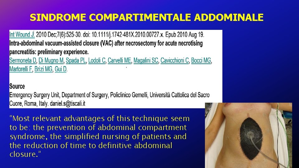 SINDROME COMPARTIMENTALE ADDOMINALE “Most relevant advantages of this technique seem to be: the prevention