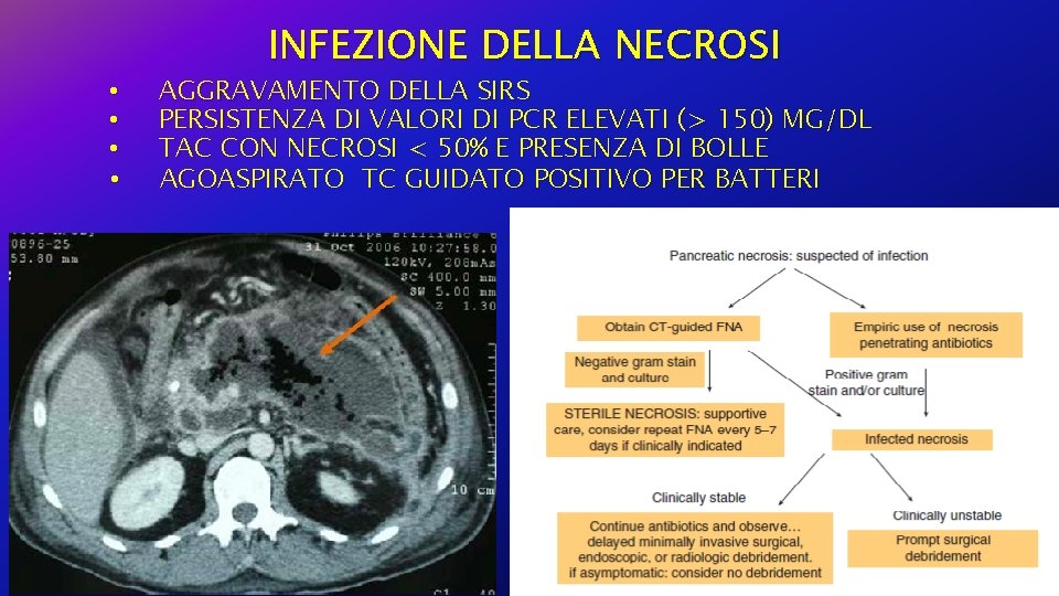  • • INFEZIONE DELLA NECROSI AGGRAVAMENTO DELLA SIRS PERSISTENZA DI VALORI DI PCR