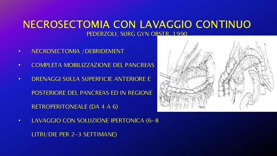 NECROSECTOMIA CON LAVAGGIO CONTINUO PEDERZOLI; SURG GYN OBSTR, 1990 • NECROSECTOMIA /DEBRIDEMENT • COMPLETA