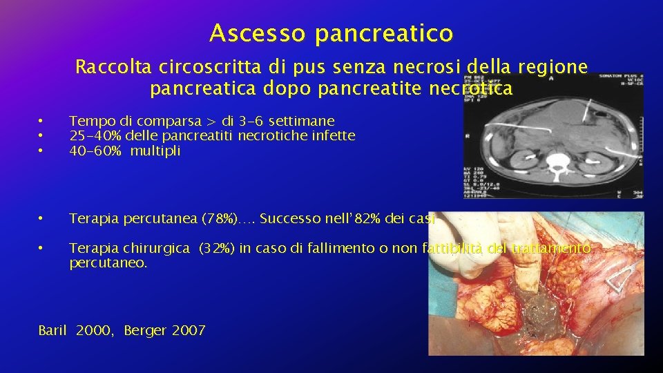 Ascesso pancreatico Raccolta circoscritta di pus senza necrosi della regione pancreatica dopo pancreatite necrotica