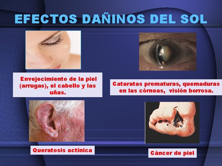 EFECTOS DAÑINOS DEL SOL Envejecimiento de la piel (arrugas), el cabello y las uñas.