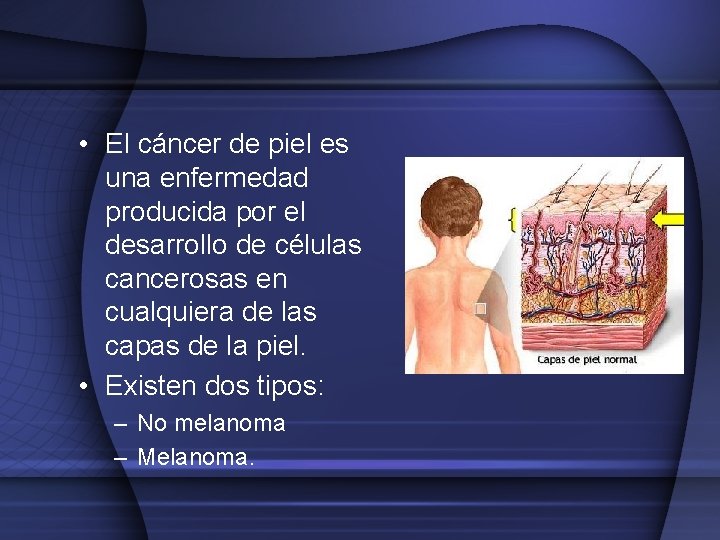  • El cáncer de piel es una enfermedad producida por el desarrollo de