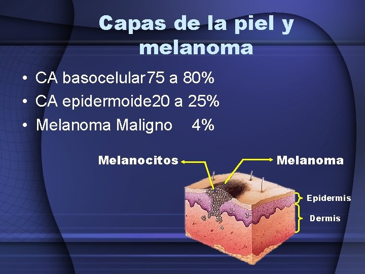 Capas de la piel y melanoma • CA basocelular 75 a 80% • CA