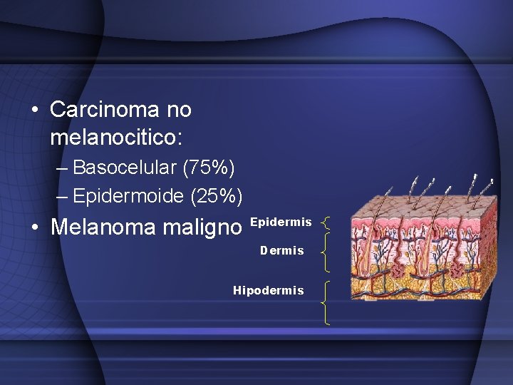  • Carcinoma no melanocitico: – Basocelular (75%) – Epidermoide (25%) • Melanoma maligno