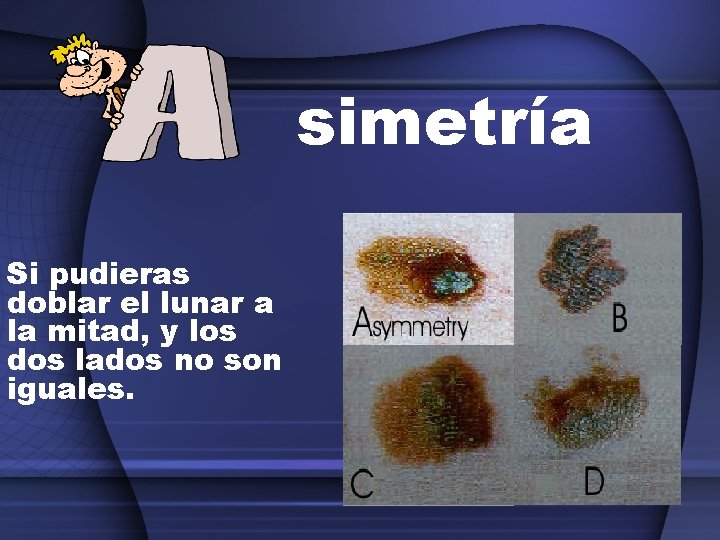 simetría Si pudieras doblar el lunar a la mitad, y los dos lados no