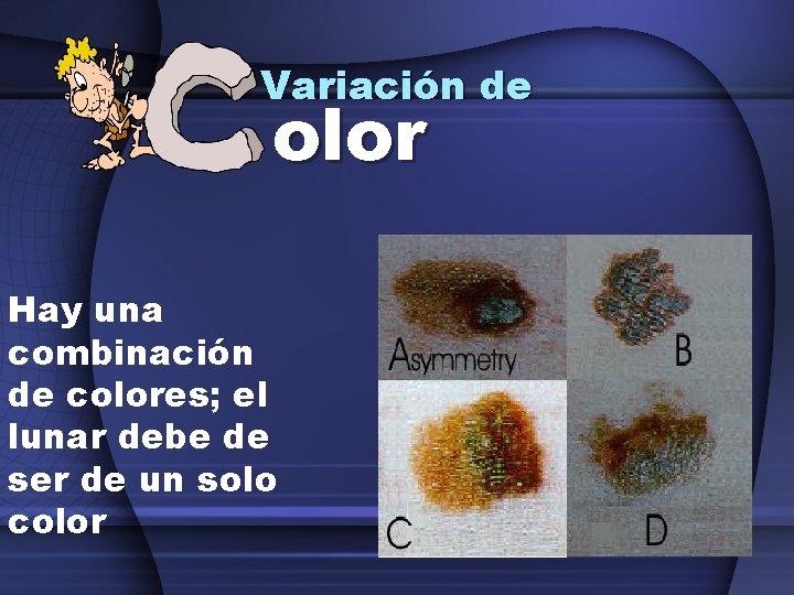 Variación de olor Hay una combinación de colores; el lunar debe de ser de
