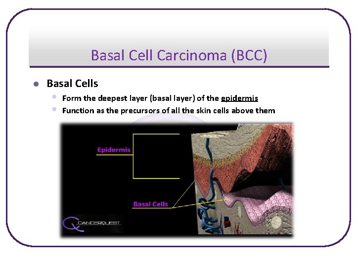 Basal Cell Carcinoma (BCC) l Basal Cells • • Form the deepest layer (basal