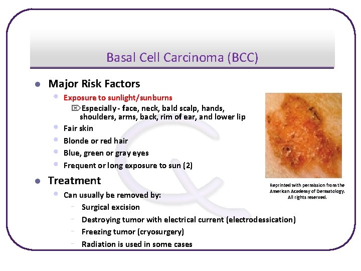 Basal Cell Carcinoma (BCC) l Major Risk Factors • • • l Exposure to