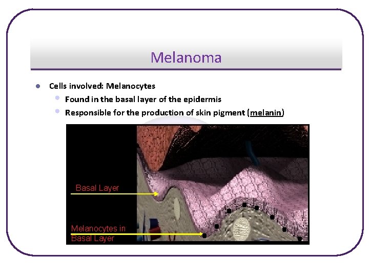 Melanoma l Cells involved: Melanocytes • Found in the basal layer of the epidermis