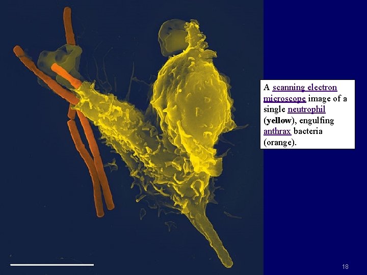 A scanning electron microscope image of a single neutrophil (yellow), engulfing anthrax bacteria (orange).