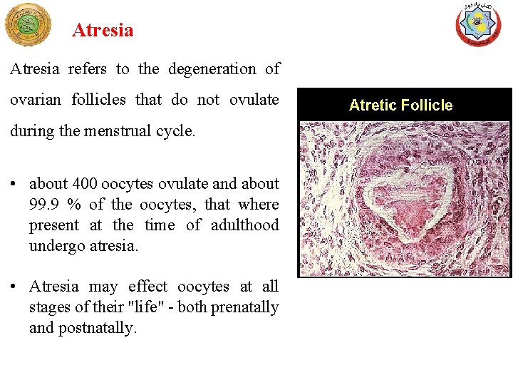 Atresia refers to the degeneration of ovarian follicles that do not ovulate during the