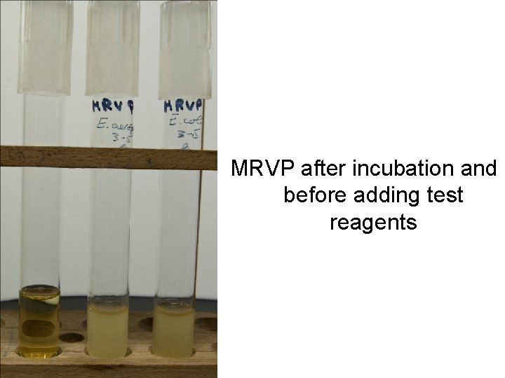 MRVP after incubation and before adding test reagents MRVP after incubation and before adding test reagents