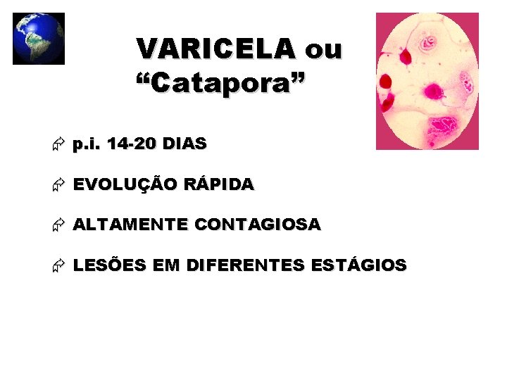 VARICELA ou “Catapora” p. i. 14 -20 DIAS EVOLUÇÃO RÁPIDA ALTAMENTE CONTAGIOSA LESÕES EM