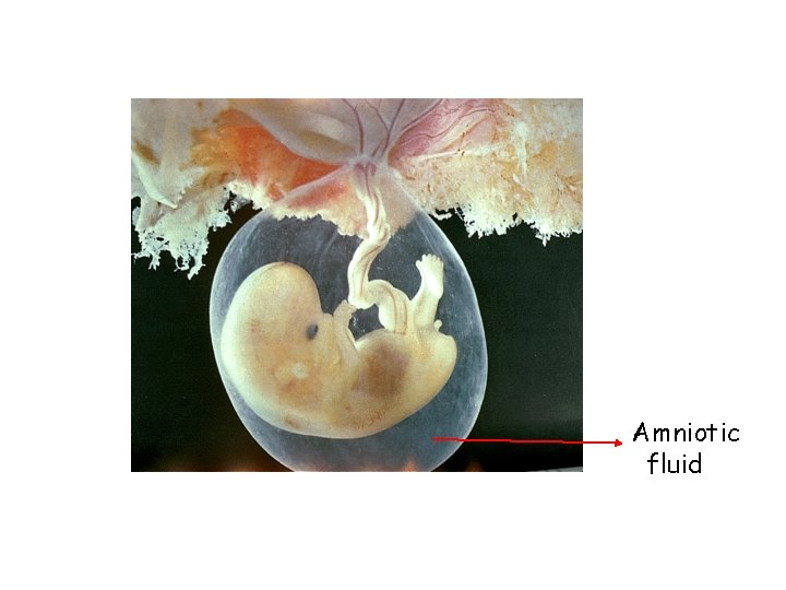 Amniotic fluid 