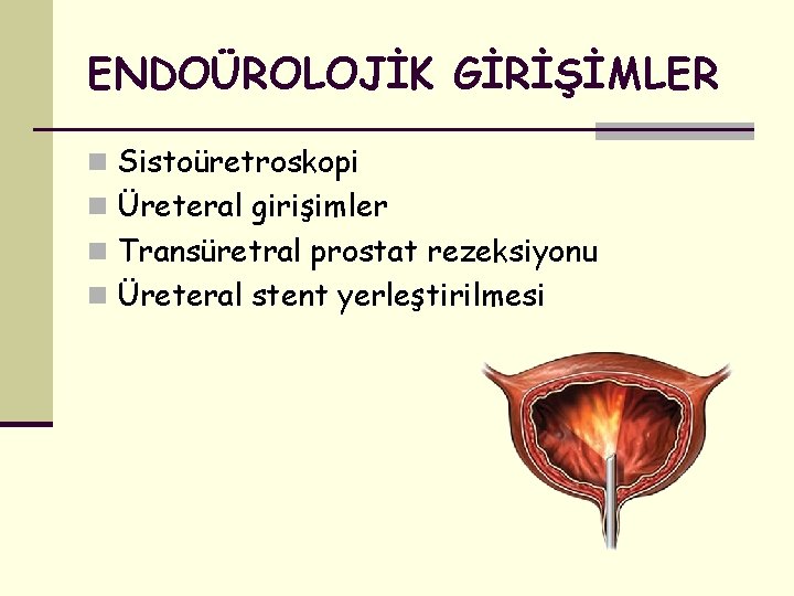 ENDOÜROLOJİK GİRİŞİMLER n Sistoüretroskopi n Üreteral girişimler n Transüretral prostat rezeksiyonu n Üreteral stent