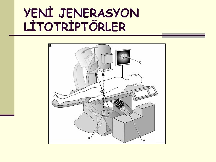 YENİ JENERASYON LİTOTRİPTÖRLER 