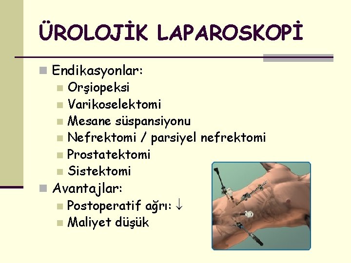 ÜROLOJİK LAPAROSKOPİ n Endikasyonlar: n Orşiopeksi n Varikoselektomi n Mesane süspansiyonu n Nefrektomi /