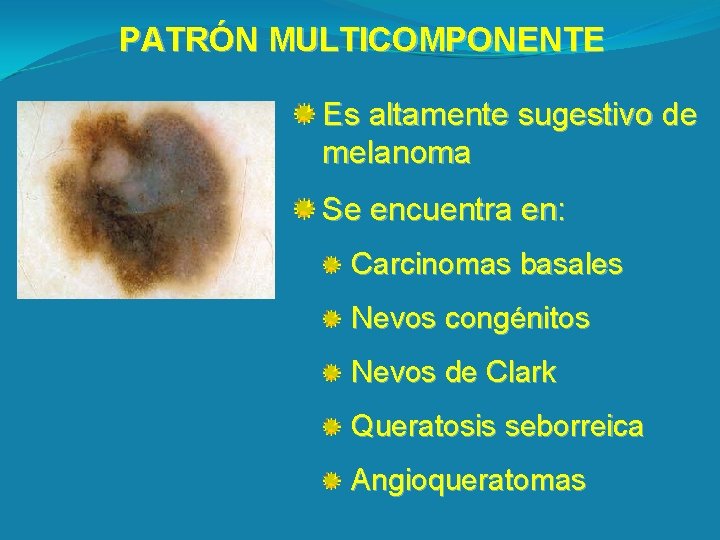 PATRÓN MULTICOMPONENTE Es altamente sugestivo de melanoma Se encuentra en: Carcinomas basales Nevos congénitos