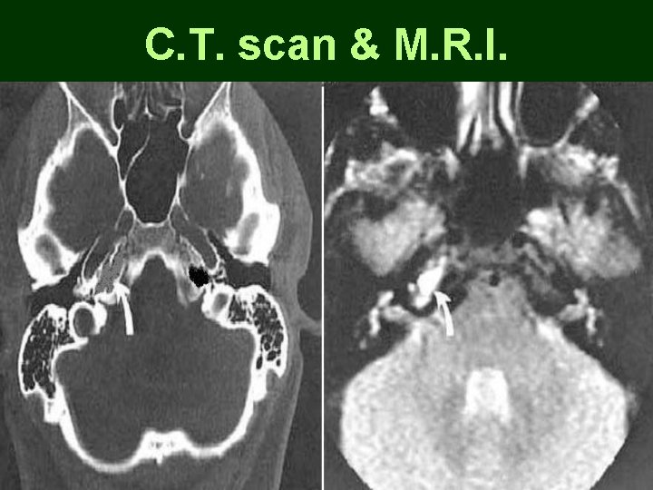 C. T. scan & M. R. I. C. T. scan & M. R. I.